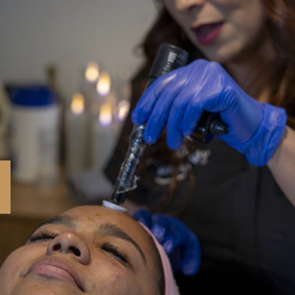 MICROCHANNELING PROCELL at The Utah Spa and Wellness Center in Provo, UT