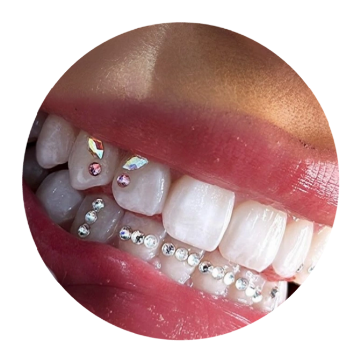 Crystal Tooth Gem Customization