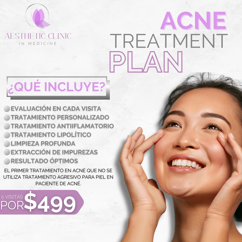 Acne Treatment