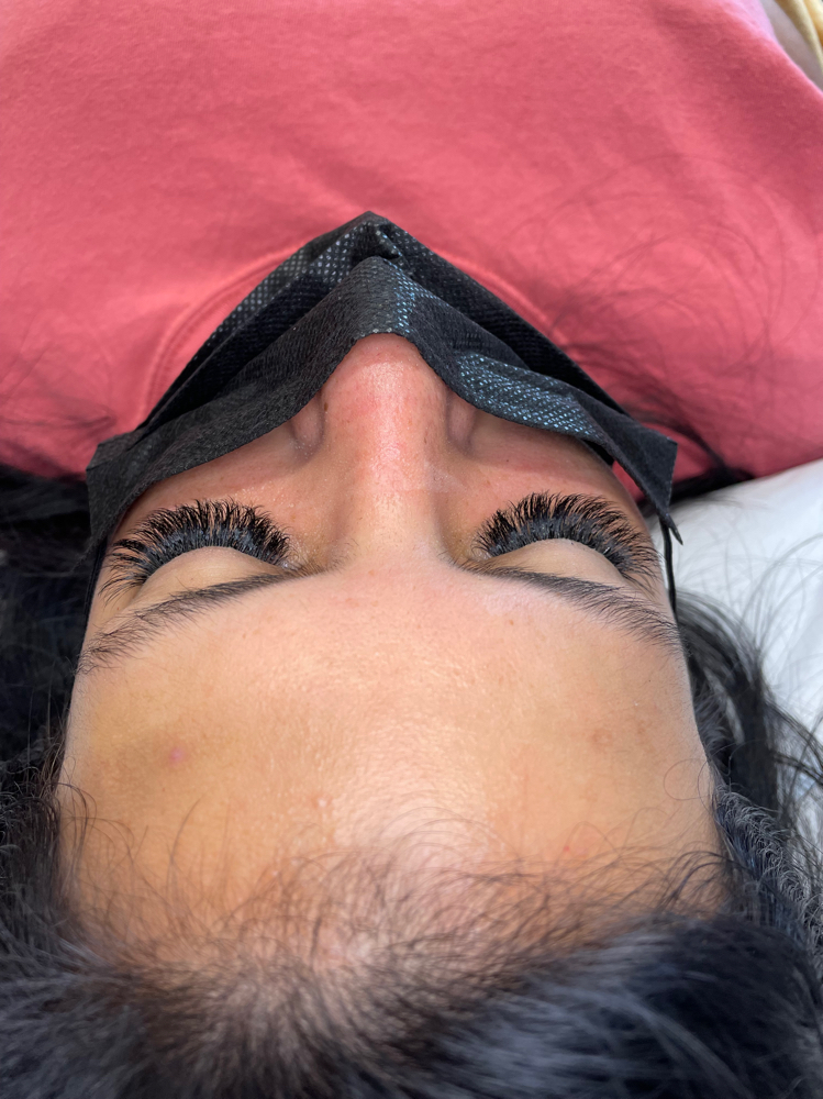 Volume Touch Up / Fill (0-2 Weeks)