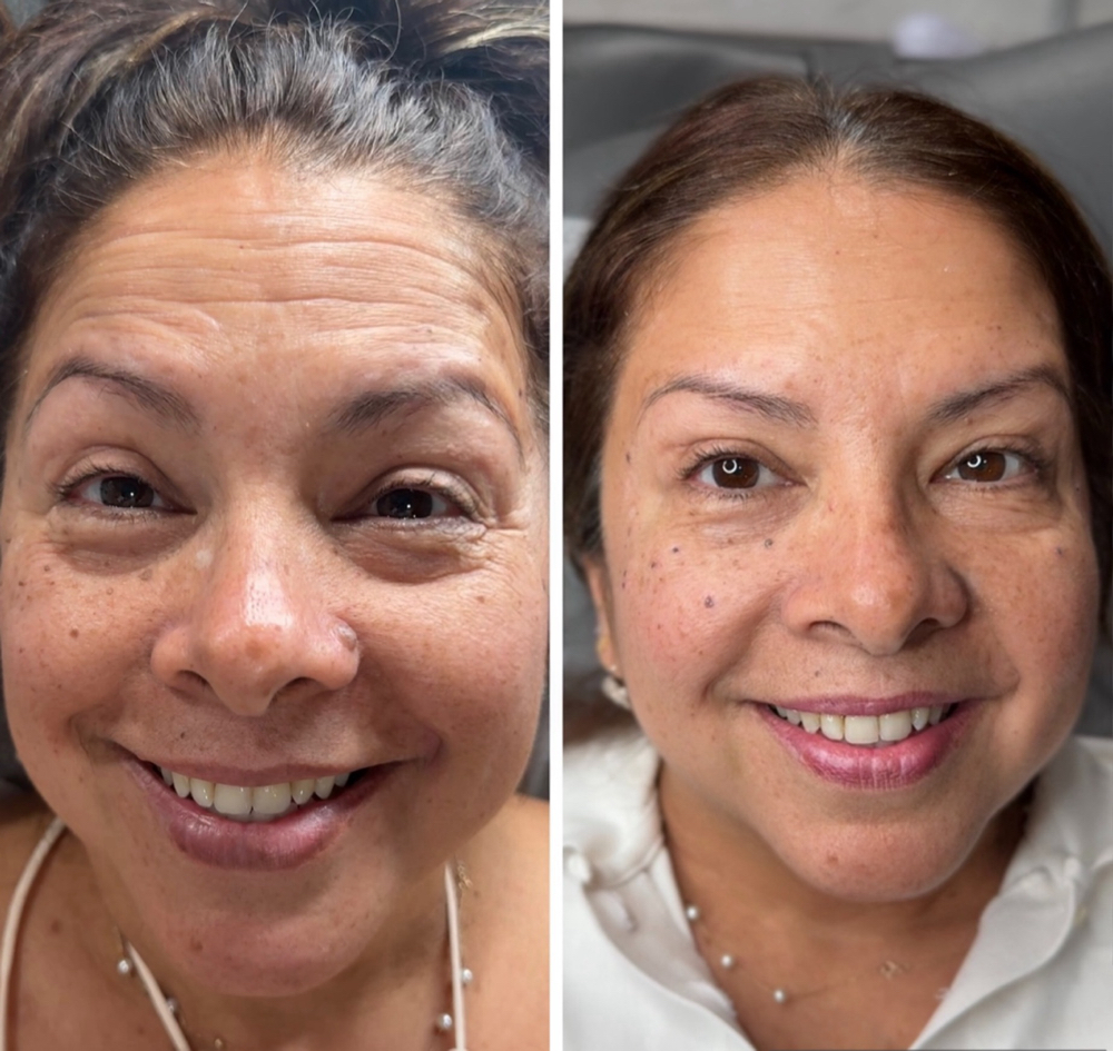 Artistry “Wrinkle Relaxer (12/u)”