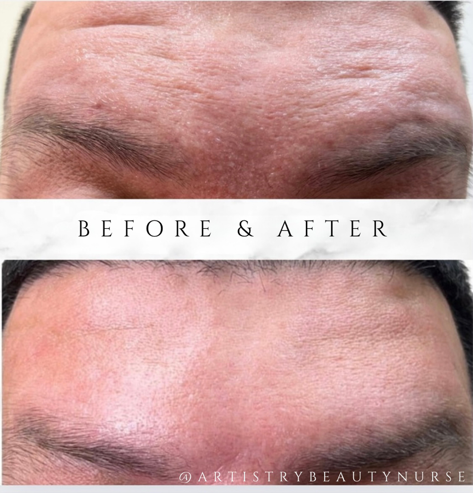 Artistry “Wrinkle Relaxer (12/u)”