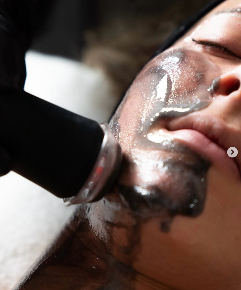 Belle O₂ Treatment