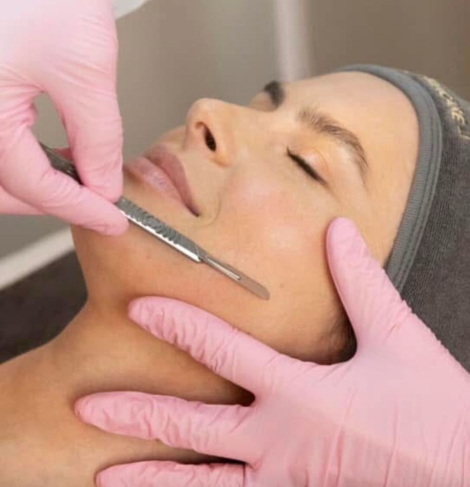 Dermaplaning Facial