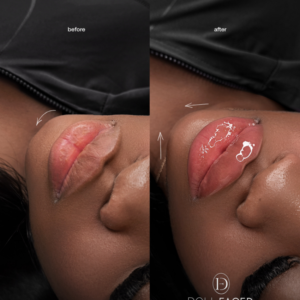 LIPS & CHIN at DOLLFACED Inc in Queens, NY