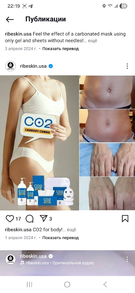 Carboxy CO2 Therapy (Back)