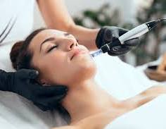 Microneedling