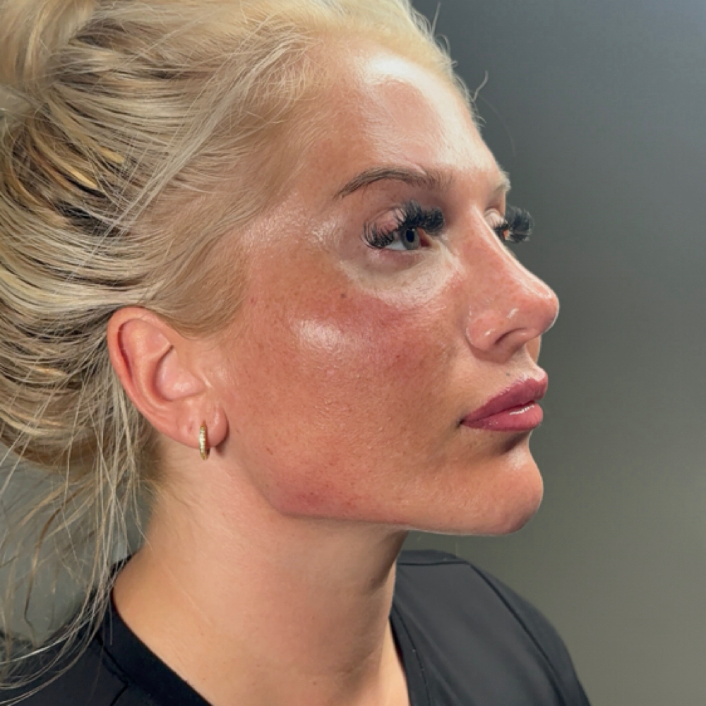 The Opulence Signature Sculpt at Opulence Beaute in Dunwoody Ga, GA
