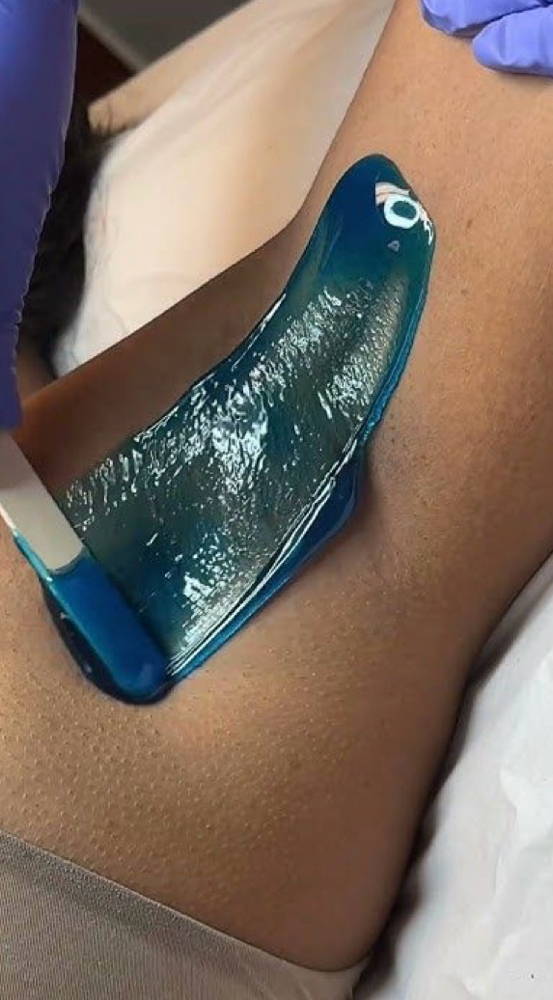 Underarm Waxing