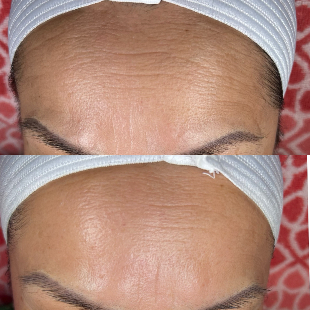 Lift & Sculp Facial at Jisell Aesthetics in Houston, TX