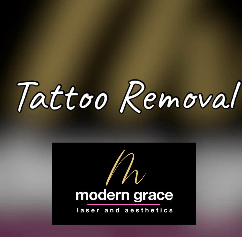 Tattoo Removal at Modern Grace Laser and Aesthetics in San Tan Valley, AZ