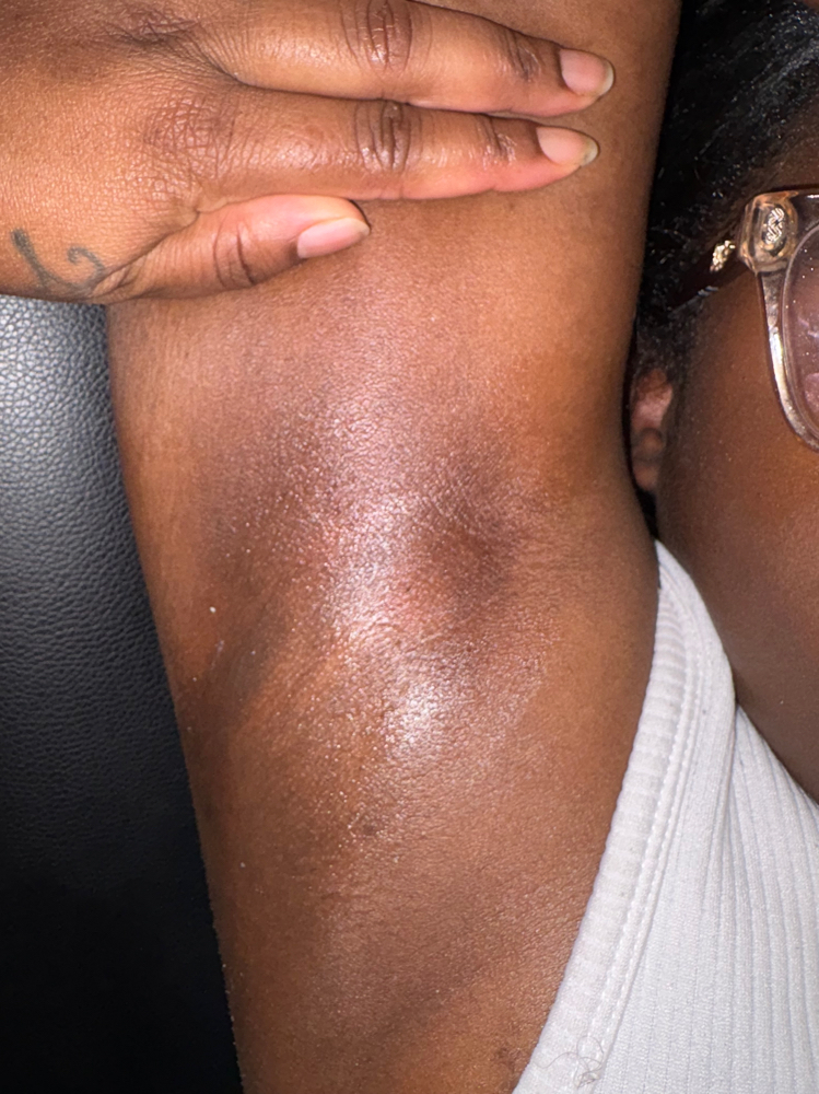 Underarm