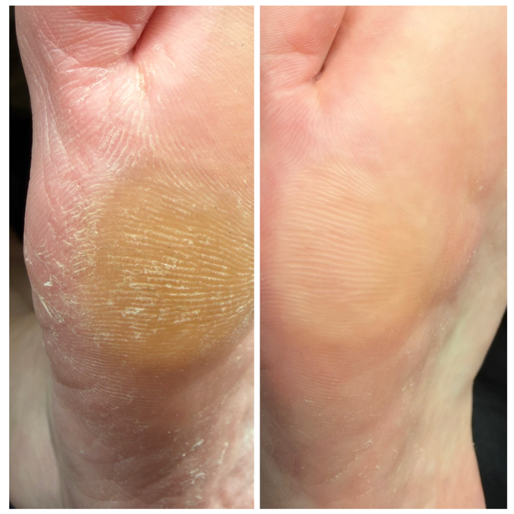 Wellness Pedicure at Divine Goddess | Wellness Nail Reconstructions in Spring Hill, FL