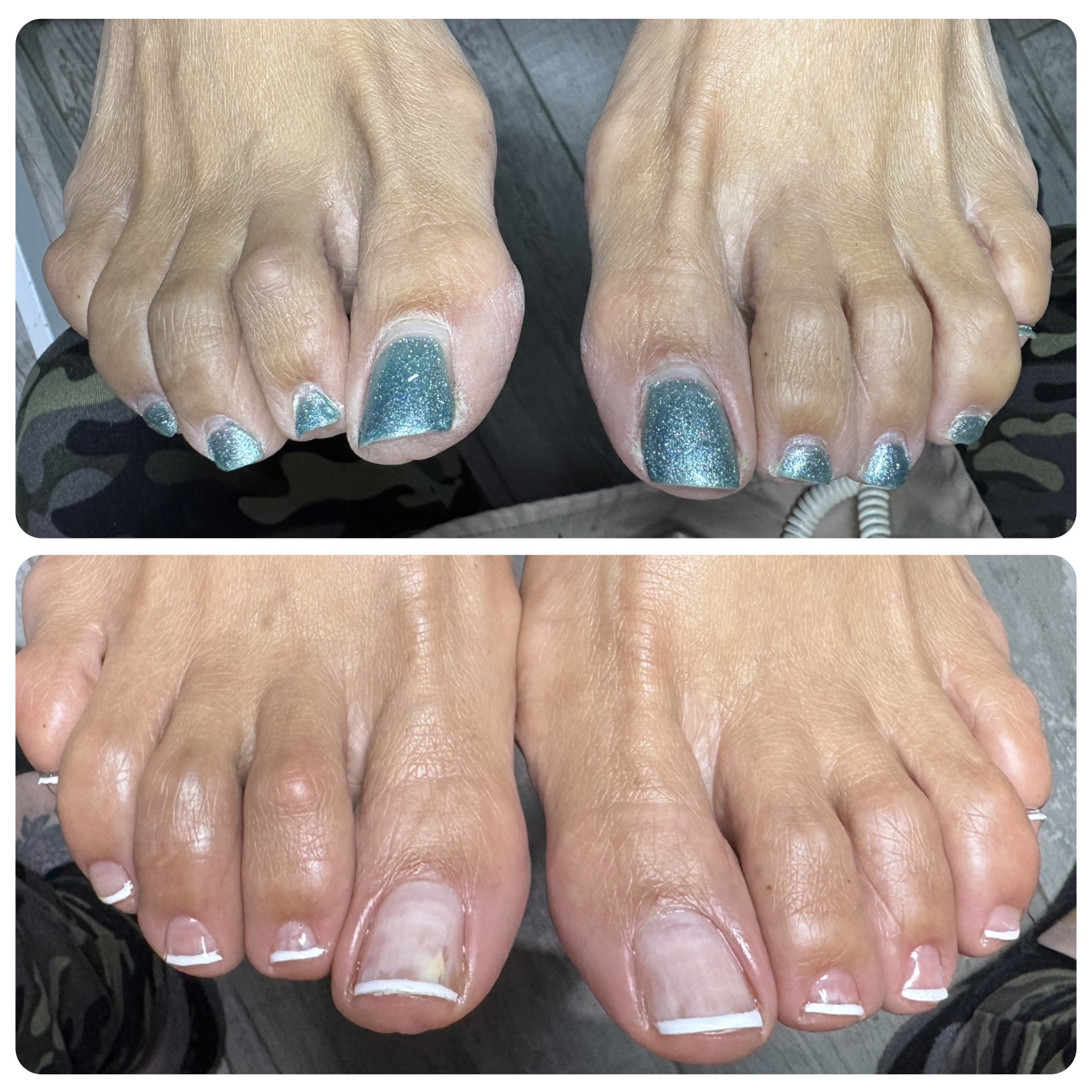 Pedicure
