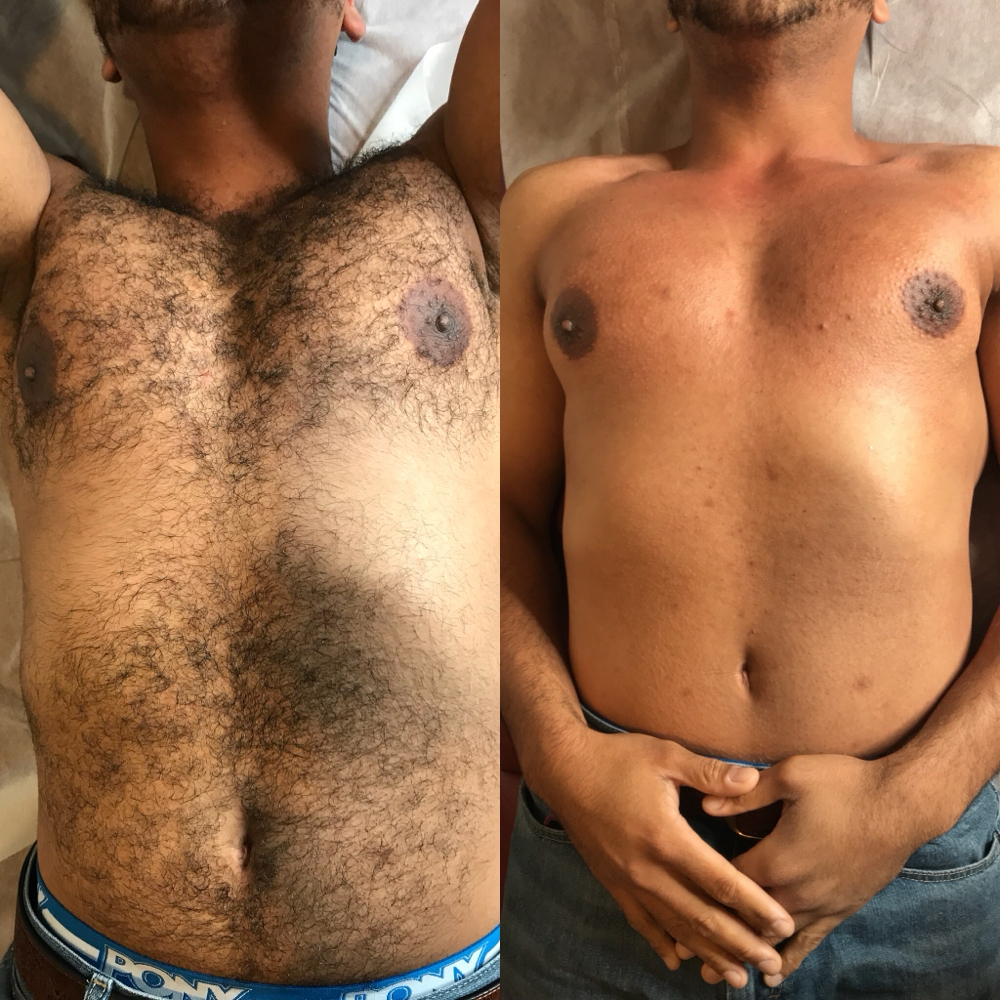Full Chest