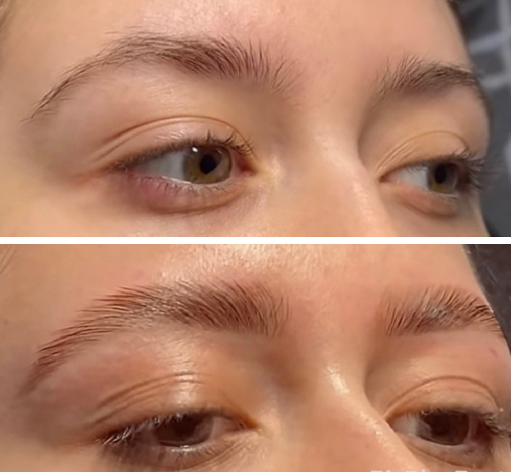 Brow Lamination