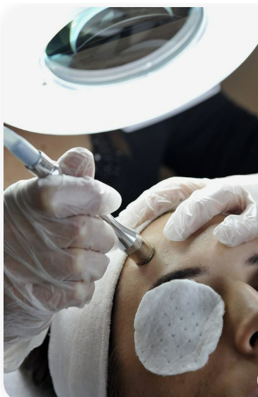 Microdermabrasion Facial