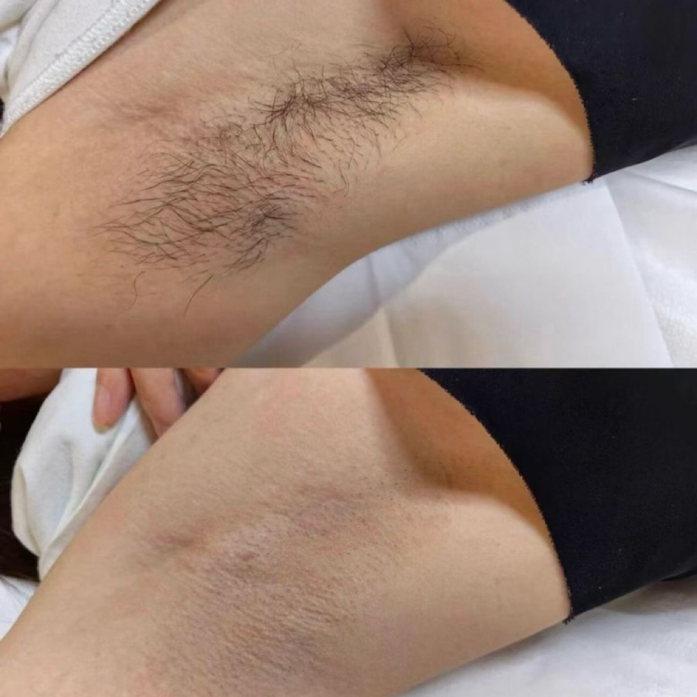 Underarm waxing/ depilación de axil at Gigi’s Beauté LLC in Lanham, MD