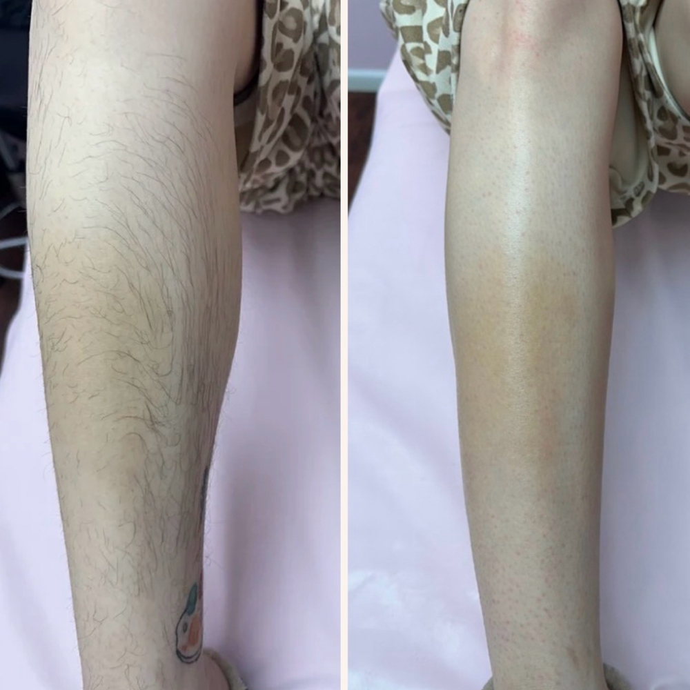 Full Legs at Metanoia Beauty in Lubbock, TX