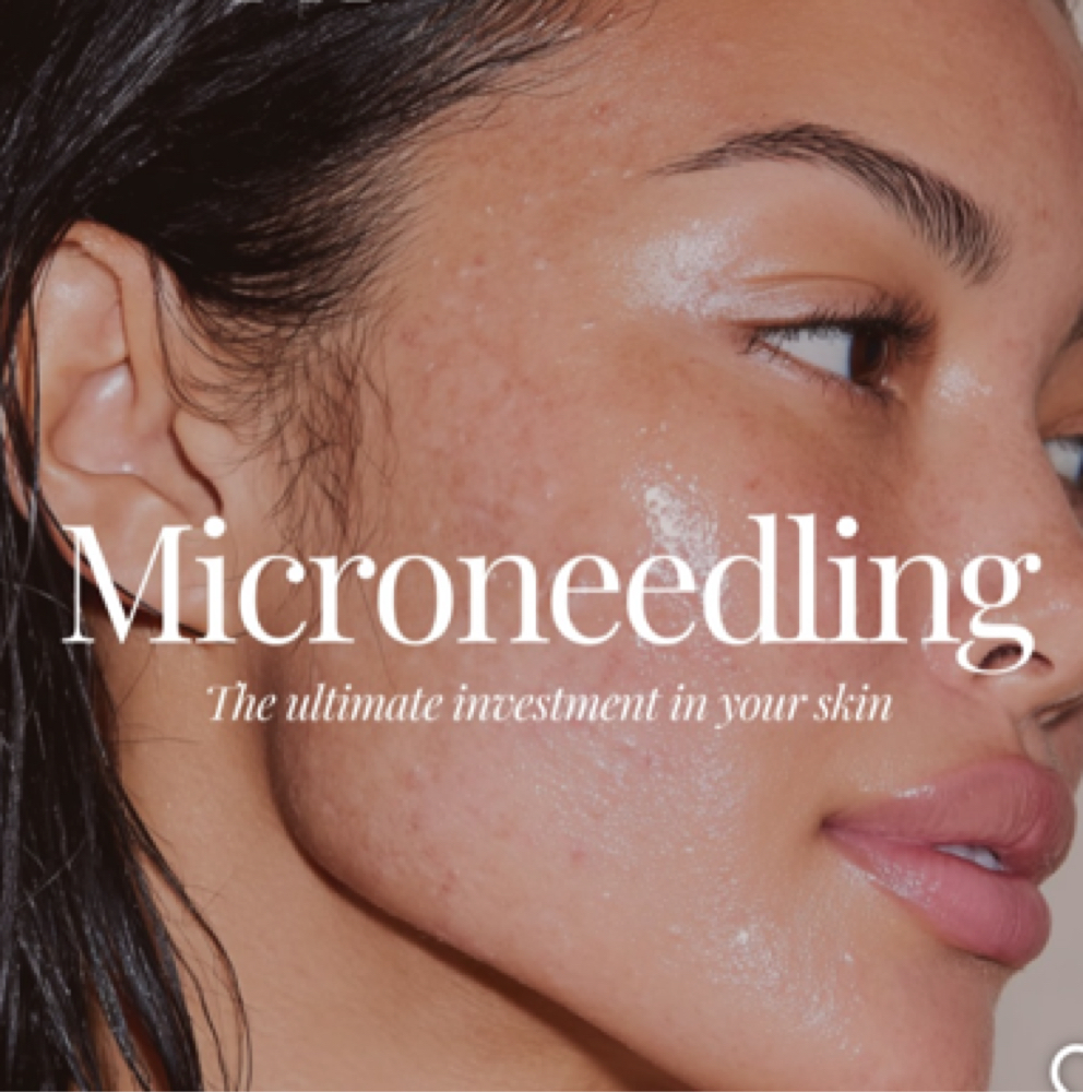 Skinpen Microneedling | Face + Neck at Lace Skn in West Lake Hills, TX