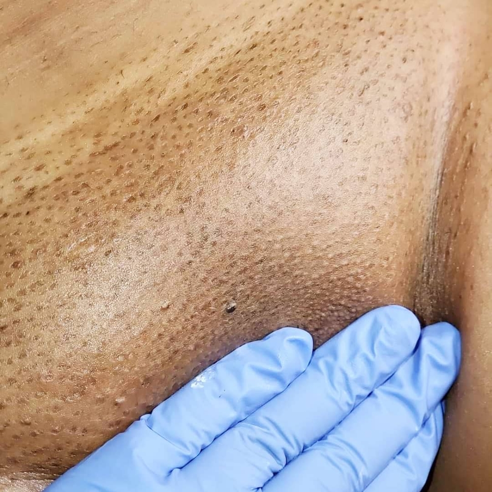 Brazilian Wax