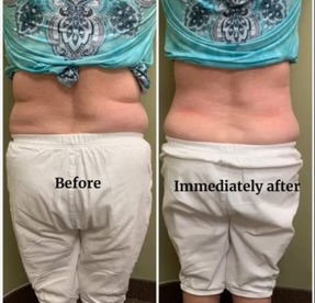 Body-Neveskin Single Body Treatment