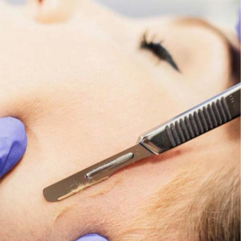 Peak Polish (dermaplane) at Alpine Glow Aesthetics, LLC in Colorado Springs, CO