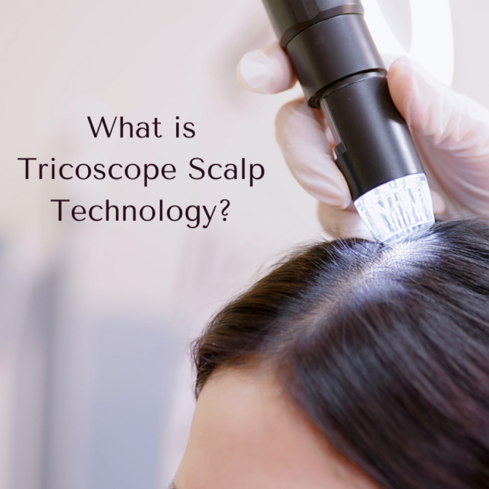 Scalp Analysis With Camera at Hair IQ Salon & Spa in Weslaco, TX