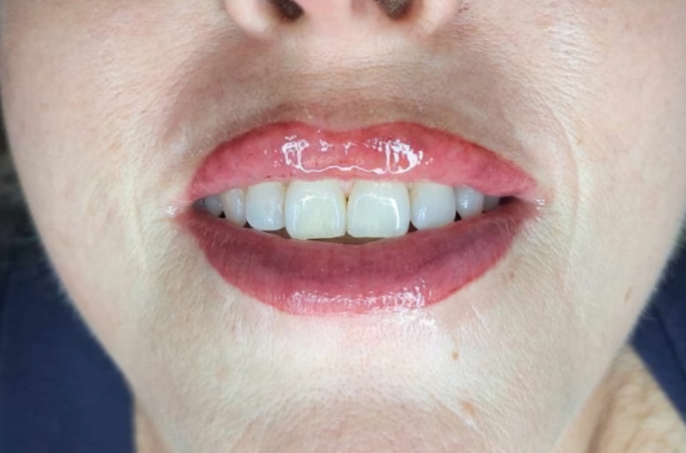 Lip Blushing Touch Up