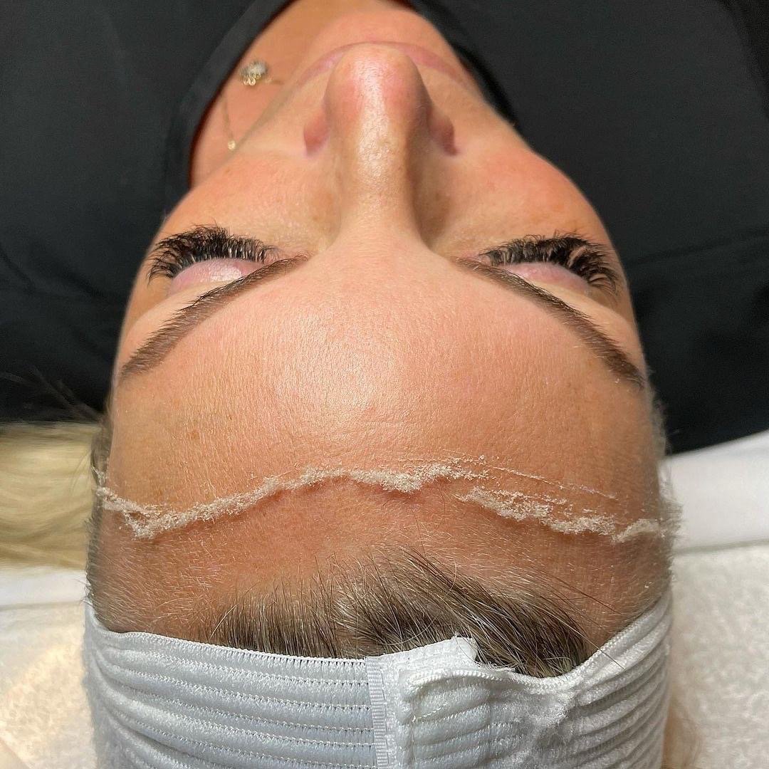 Teatime Dermaplane (Mini-Treatment) at Jennifer Marie Skincare in Elkhart, IN