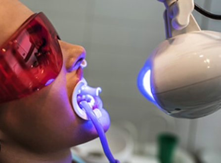 TEETH WHITENING - 60 MINS