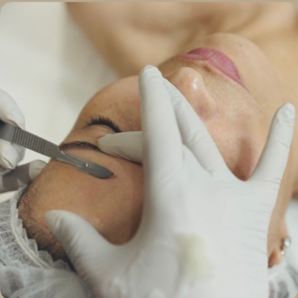 Express Dermaplane at Ella Myer Esthetics in Pensacola, FL