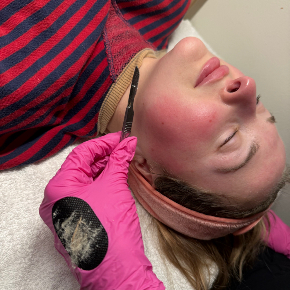 Silk Glow Dermaplane Facial at Haleyskinbar in Weymouth, MA