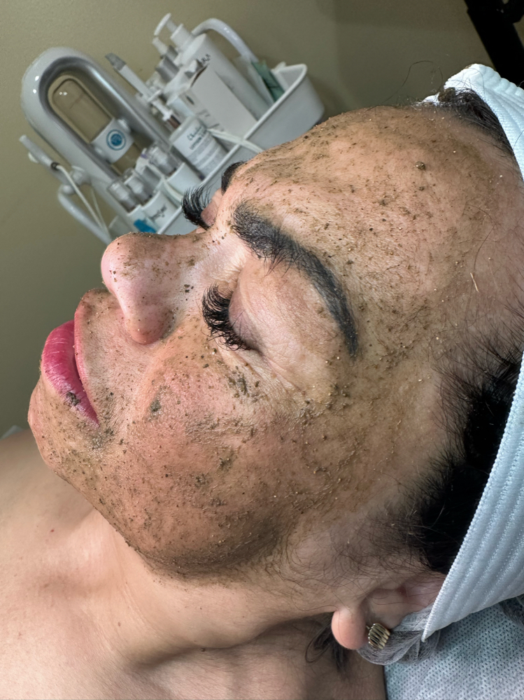 Peeling De Alga