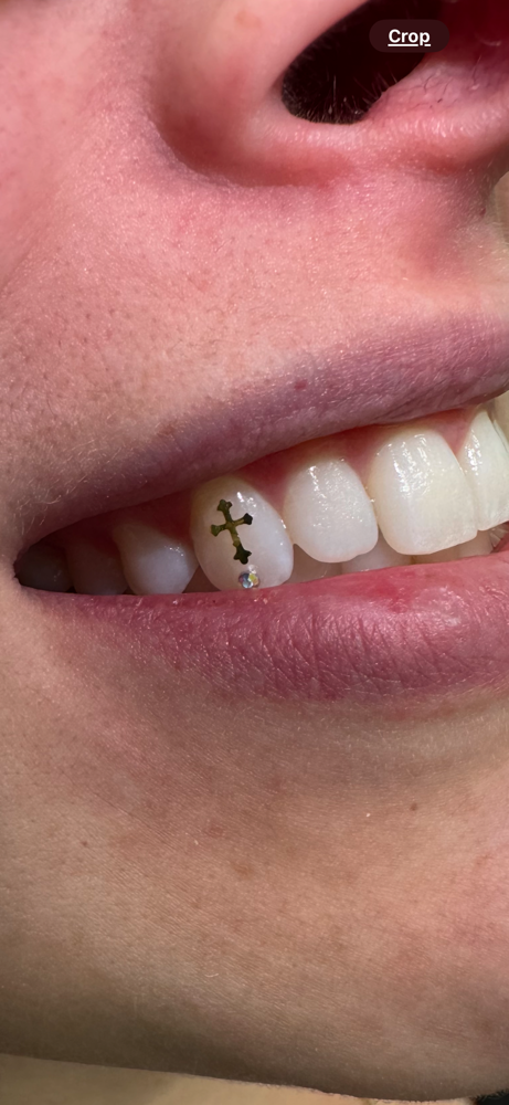 Tooth Gems