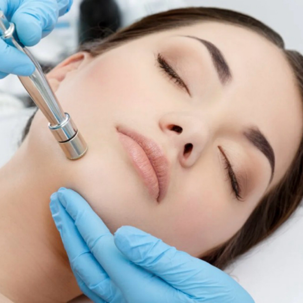 Microdermabrasion Facial at Brows and Beauty in Stockton, CA