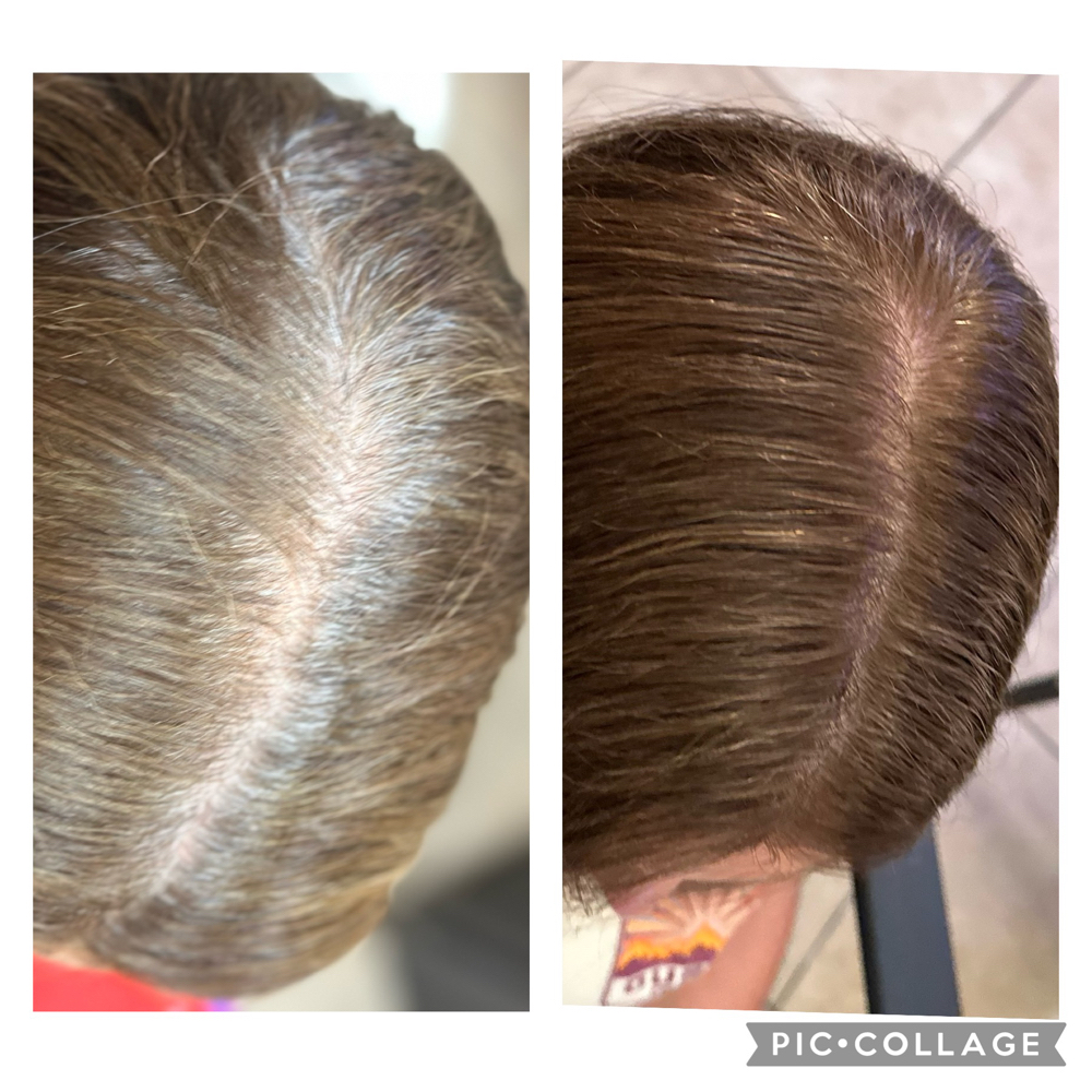 Root Touch-Up