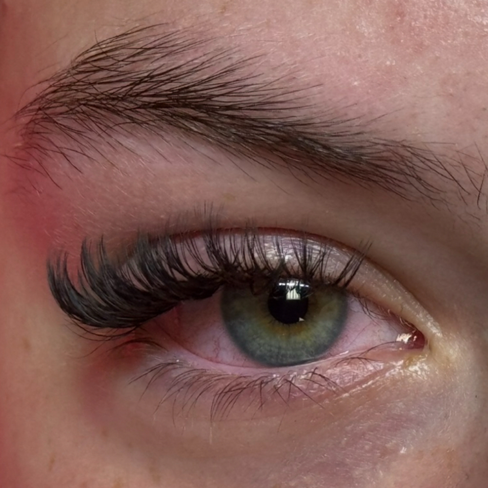 Wet Set Fill at Graceful Glow Aesthetics in Paducah, KY