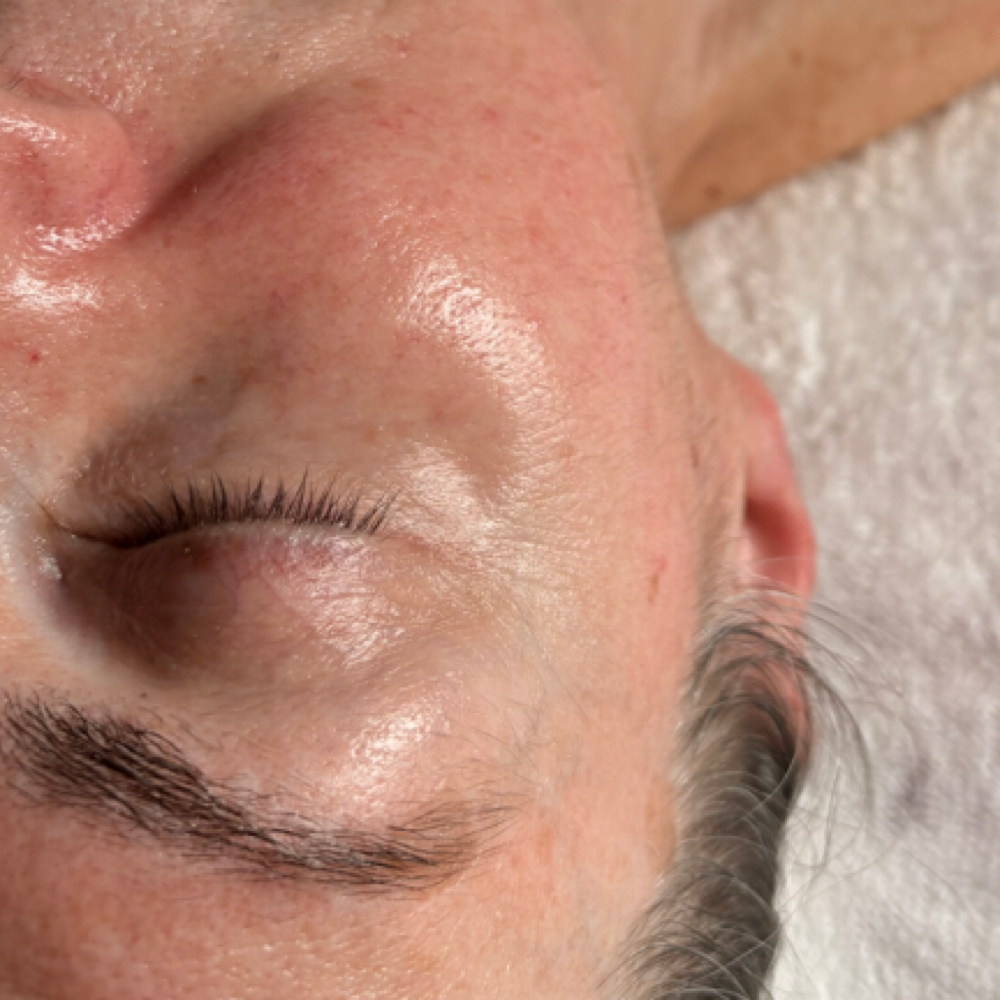 Eye Treatment at Dream Skin in Kingston, NY