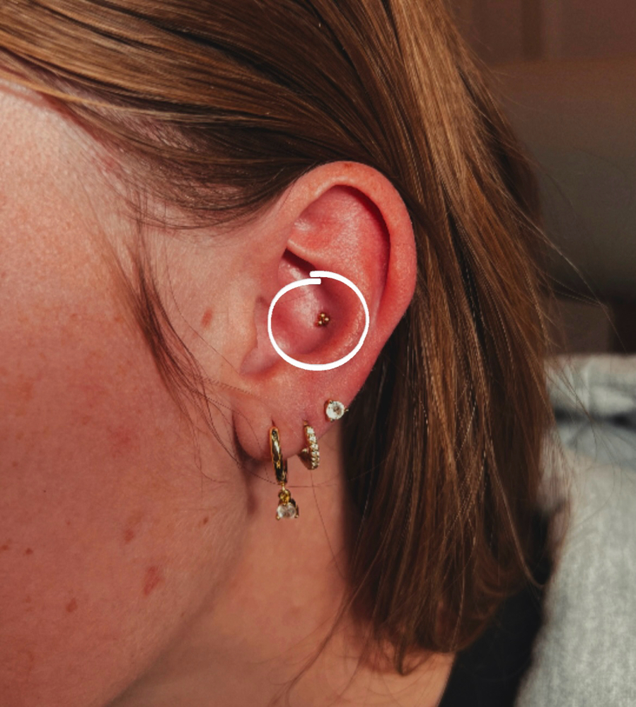 Conch | Hollow Needle Ear Piercing