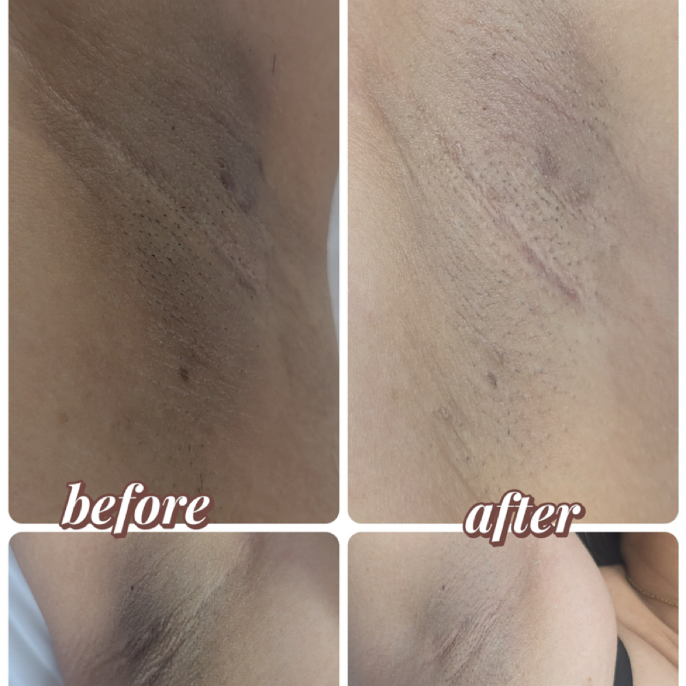 Intimate Brightening at Nenusk Aesthetics in Long Island City, NY