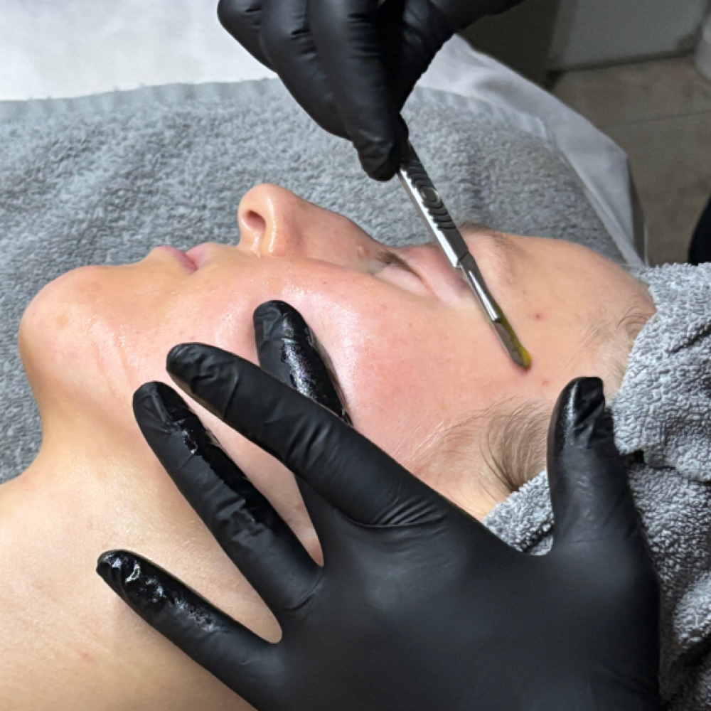 Dermaplaning Facial at The Skin Co. in Orange, CA