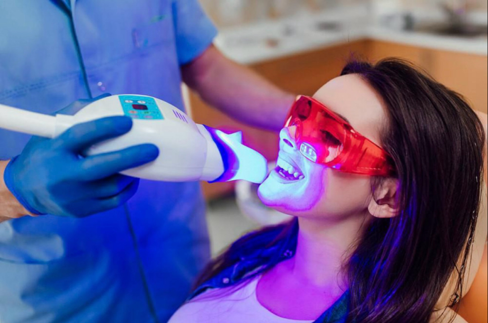 Teeth Whitening Bundle (3 Sessions)