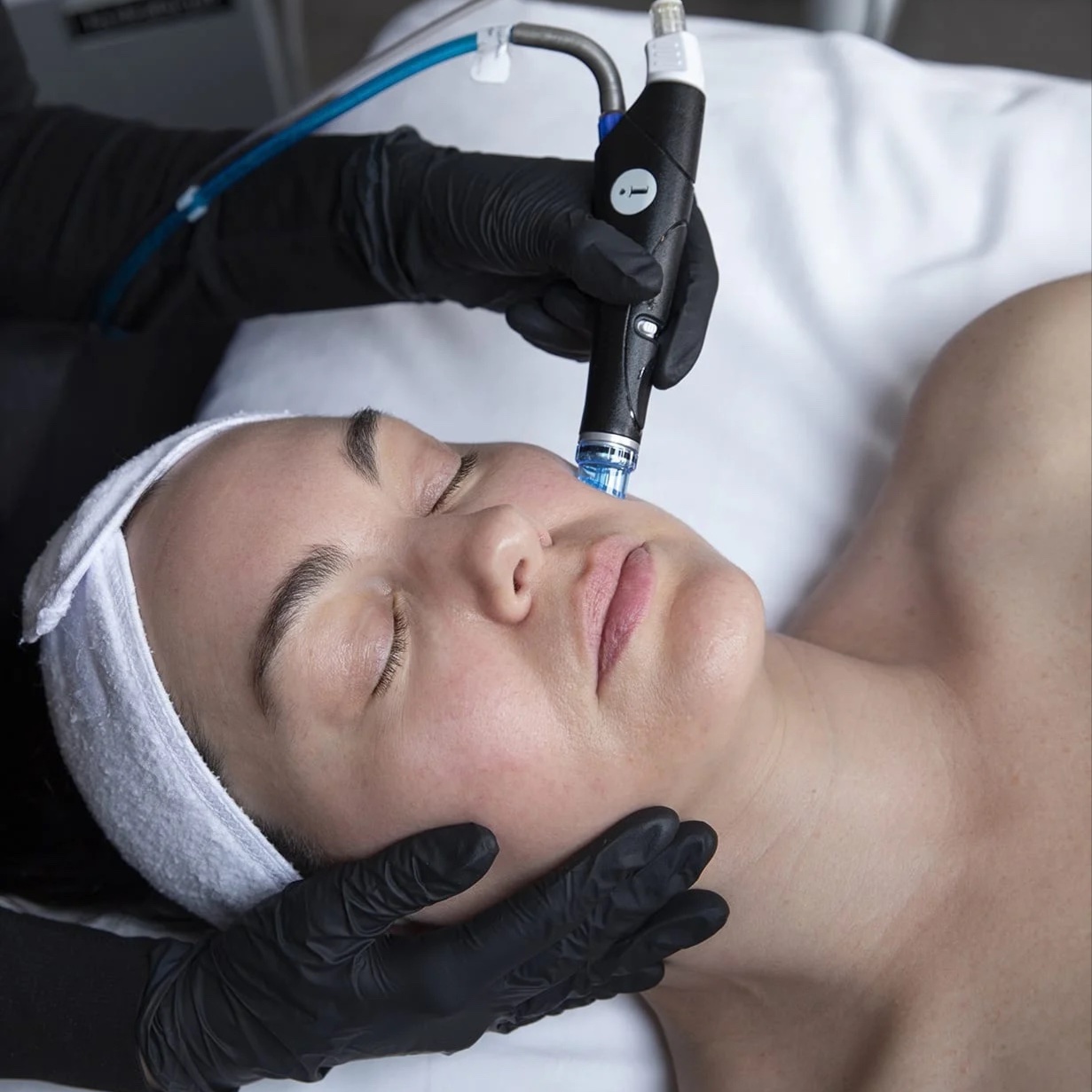 Express HydraFacial at Vanity Beauty in Saratoga Springs, NY