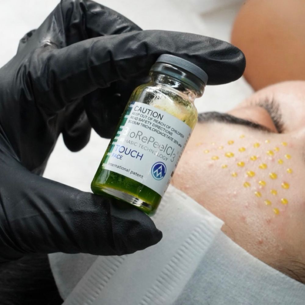 Bio RePeel at Brow Boss Beauty Bar in Fort Lauderdale, FL