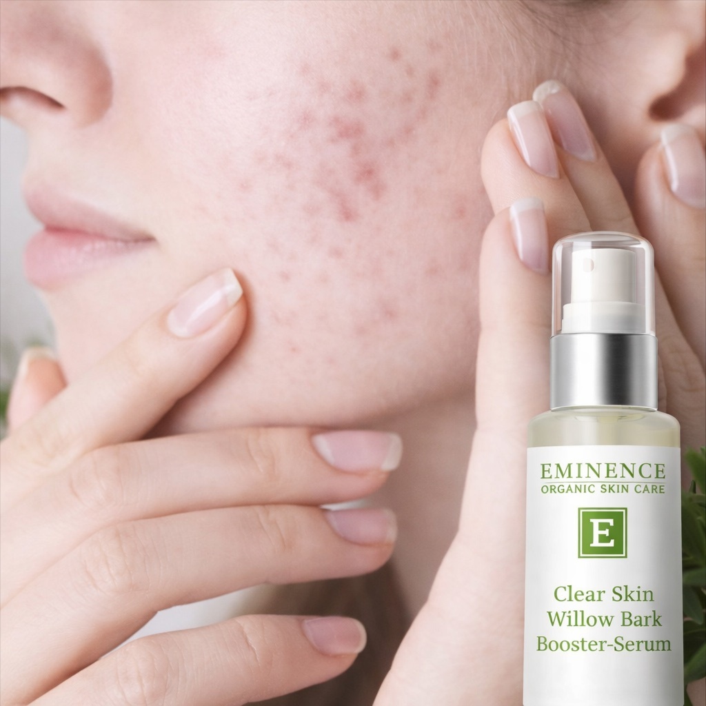 Acne Refinement Facial at Tracy WellBeing Retreat in Tracy, CA