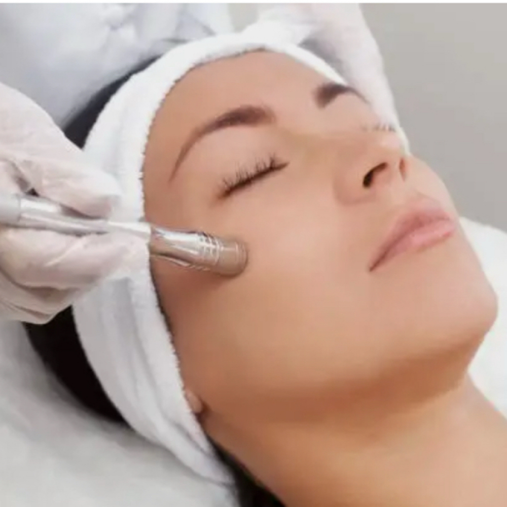 Microdermabrasion at Janice Nicole Aesthetics in Albuquerque, NM