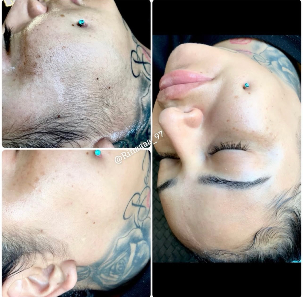 Dermaplane Facial