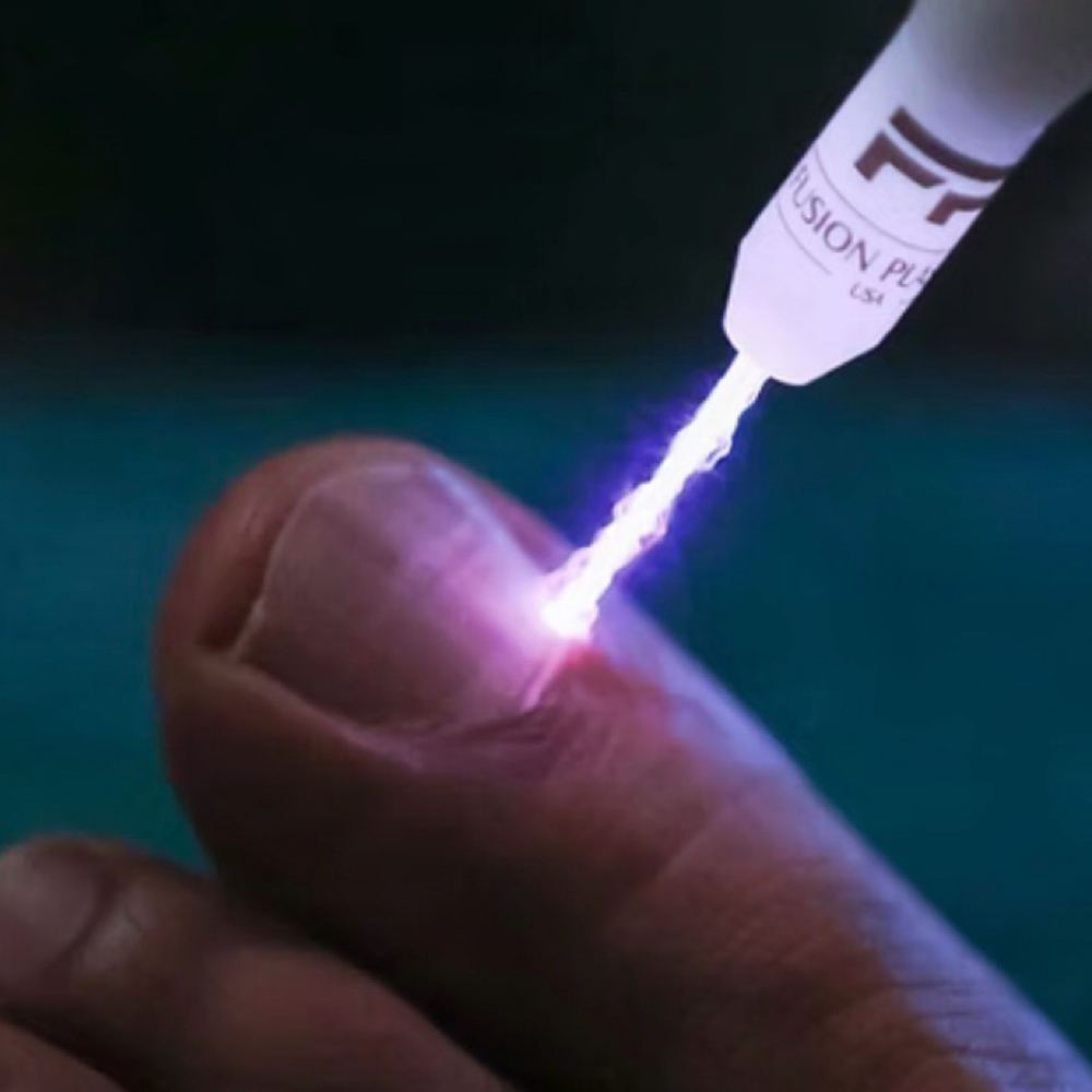 NAIL FUNGUS TREATMENT at Beauty and Brows in Queens, NY