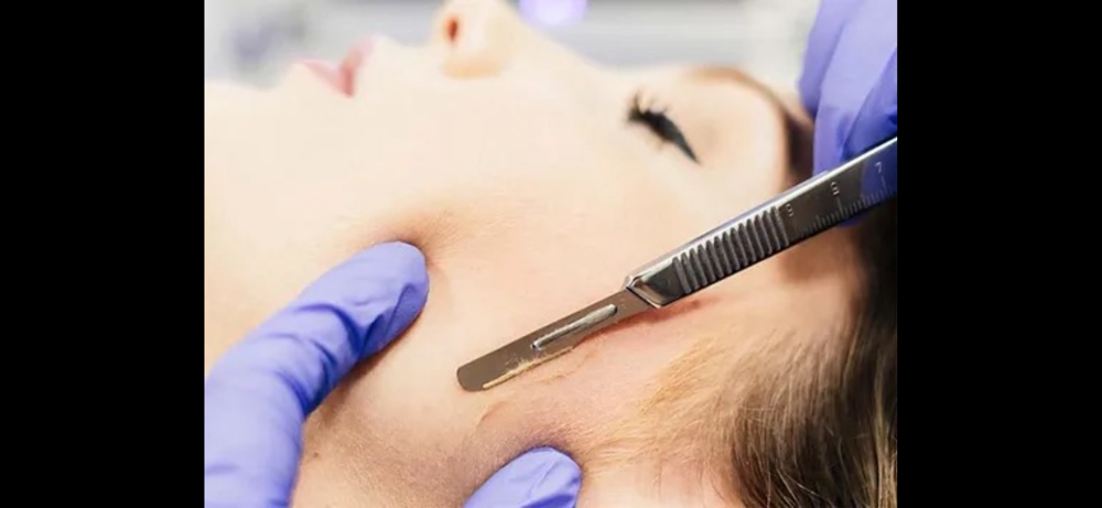 DERMAPLANE ADD ON at Skin with Em in Oxford, AL